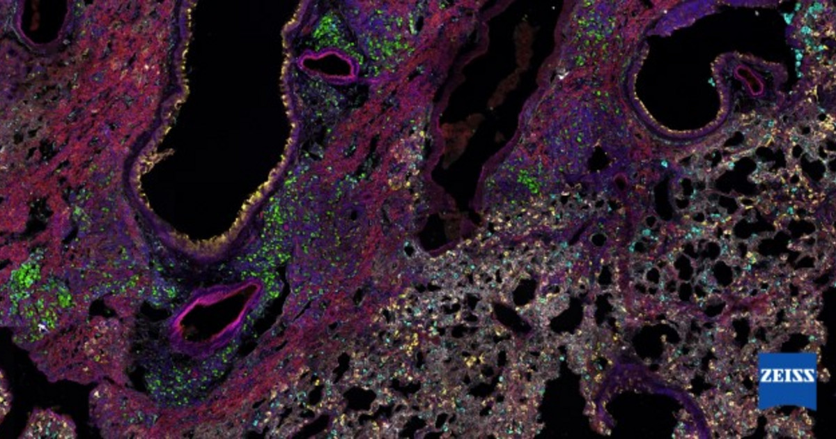 Case Study: Spatial Biology Studies In Lung Tissue Using Spectral 