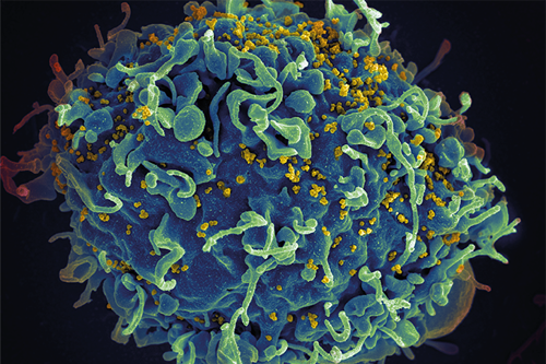 0425-101-AI-News-Biosensor-HIV-Test-Delivers-Results-in-15-Minutes_Teaser.png