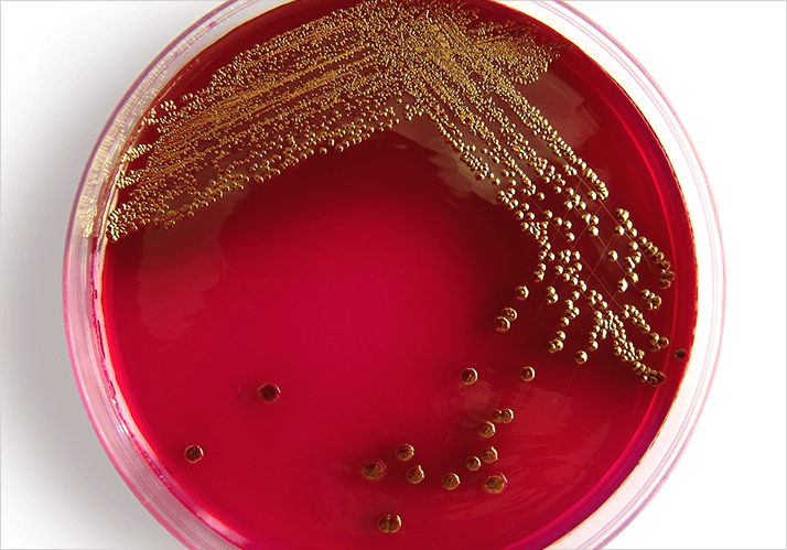 0913-204-germs img